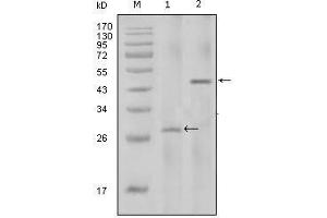 Western Blot showing IL2 antibody used against full-length IL2 recombinant protein with Trx tag (1) and full-length IL2-hIgGFc transfected HEK293 cell lysate (2). (IL-2 anticorps)