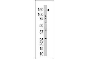 The USP28 polyclonal antibody  is used in Western blot to detect USP28 in Jurkat cell lysate . (USP28 anticorps  (N-Term))