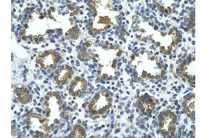 Rabbit Anti-GUSB Antibody       Paraffin Embedded Tissue:  Human alveolar cell   Cellular Data:  Epithelial cells of renal tubule  Antibody Concentration:   4. (Glucuronidase beta anticorps  (C-Term))