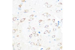 Immunohistochemistry of paraffin-embedded rat brain using TCTP/TPT1 Rabbit mAb (ABIN7271101) at dilution of 1:100 (40x lens).