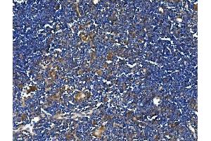 IHC analysis of TRIM6 using anti-TRIM6 antibody (ABIN7601905). (TRIM6 anticorps  (AA 50-349))