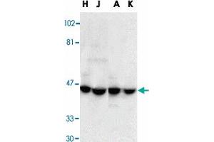 Western blot analysis of DFFA in HeLa (H), Jurkat (J), A-431 (A), and K-562 (K) whole cell lysate with DFFA polyclonal antibody  at 1 : 1000 dilution. (DFFA anticorps  (AA 313-331))