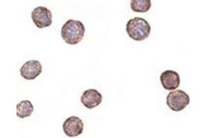 Immunohistochemistry of CXCR4Lo in HeLa cells with CXCR4Lo antibody at 2 μg/ml.