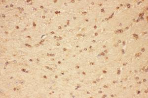 Anti-CNTF Picoband antibody,  IHC(P): Mouse Brain Tissue