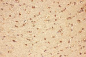 Anti-CNTF Picoband antibody,  IHC(P): Mouse Brain Tissue