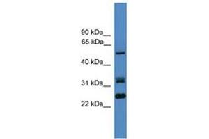 LRRFIP2 抗体  (AA 51-100)