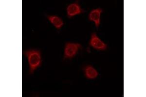 ABIN6275034 staining Hela by IF/ICC.