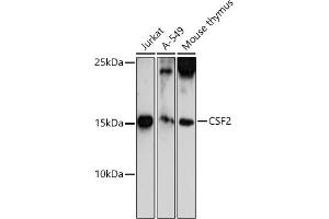 Western blot analysis of extracts of various cell lines, using CSF2 antibody (ABIN6130426, ABIN6139094, ABIN6139095 and ABIN6221725) at 1:500 dilution. (GM-CSF anticorps  (AA 18-144))