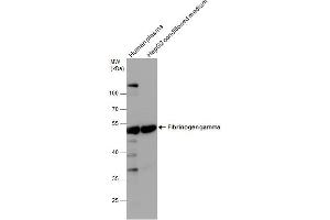 WB Image Fibrinogen gamma antibody detects Fibrinogen gamma protein by western blot analysis.