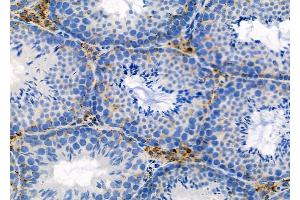 ABIN6262680 and ABIN6277697 at 1/100 staining Mouse testis tissue by IHC-P.