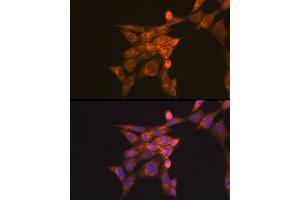 Immunofluorescence analysis of NIH-3T3 cells using Folate Binding Protein(FBP) / FOLR1 Rabbit pAb (ABIN7267224) at dilution of 1:100 (40x lens).