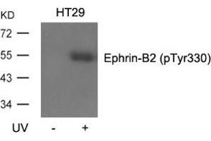 Western blot analysis of extracts from HT29 cells, untreated or treated with UV using Ephrin-B2 (Phospho-Tyr330). (Ephrin B2 anticorps  (pTyr330))