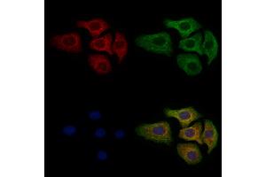 ABIN6263407 and ABIN6279151 staining Hela cells by IF/ICC. (MT-ATP6 anticorps  (Internal Region))