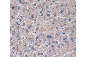 Used in DAB staining on fromalin fixed paraffin- embedded liver tissue