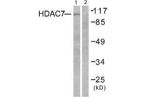 Western blot analysis of extracts from HuvEc cells, using HDAC7 antibody (ABIN5976424). (HDAC7 anticorps  (C-Term))