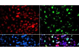 Immunofluorescence analysis of GFP-RNF168 transgenic U2OS cells using POLD3 Polyclonal Antibody (POLD3 anticorps)