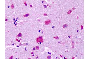 Anti-GPR83 antibody IHC of human brain, cortex, neurons.