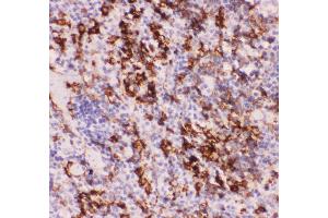 Anti-MyD88 Picoband antibody,  IHC(P): Mouse Spleen Tissue