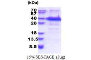 SDS-PAGE (SDS) image for Insulin-Like Growth Factor Binding Protein 7 (IGFBP7) (AA 27-282) protein (His tag) (ABIN6387352) (IGFBP7 Protein (AA 27-282) (His tag))