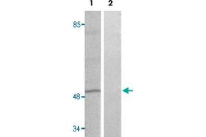 Western blot analysis of Lane 1: heat shock treated HT-29 cells, Lane 2: antigen-specific peptide treated HT-29 cells with DPYSL2 (phospho T509) polyclonal antibody  at 1:500-1000 dilution. (DPYSL2 anticorps  (pThr509))