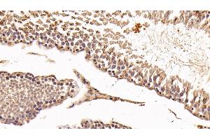 Detection of GAL8 in Rat Testis Tissue using Polyclonal Antibody to Galectin 8 (GAL8)