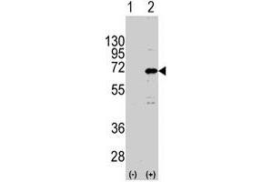 Western blot analysis of CNOT4 (arrow) using rabbit CNOT4 polyclonal antibody . (CNOT4 anticorps  (N-Term))