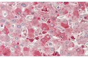 Detection of NRP1 in Human Liver Tissue using Polyclonal Antibody to Neuropilin 1 (NRP1) (Neuropilin 1 anticorps  (AA 646-814))