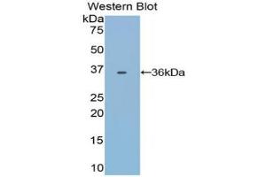 Western blot analysis of the recombinant protein. (Transferrin anticorps)