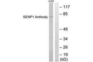 Western blot analysis of extracts from Jurkat cells, using SENP1 Antibody. (SENP1 anticorps  (AA 1-50))