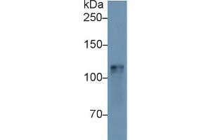 Western blot analysis of Mouse Heart lysate, using Mouse HK1 Antibody (1 µg/ml) and HRP-conjugated Goat Anti-Rabbit antibody ( (Hexokinase 1 anticorps  (AA 137-270))