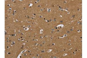 The image on the left is immunohistochemistry of paraffin-embedded Human brain tissue using ABIN7130524(PAEP Antibody) at dilution 1/60, on the right is treated with fusion protein. (PAEP anticorps)