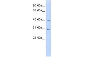 Image no. 1 for anti-Dihydroorotate Dehydrogenase (DHODH) (AA 180-229) antibody (ABIN6740743) (DHODH anticorps  (AA 180-229))