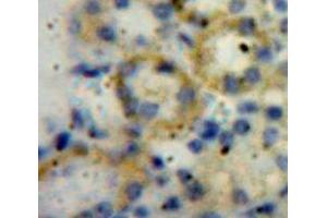 IHC-P analysis of Kidney tissue, with DAB staining. (ADAMTS1 anticorps  (AA 560-911))
