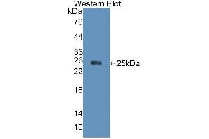 Western blot analysis of the recombinant protein. (XPO5 anticorps  (AA 2-180))