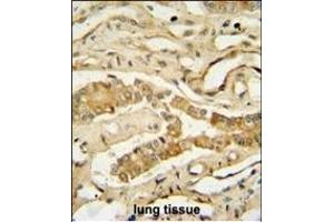 NDUF3 antibody (N-term) (ABIN654942 and ABIN2844583) immunohistochemistry analysis in formalin fixed and paraffin embedded human lung tissue followed by peroxidase conjugation of the secondary antibody and DAB staining.