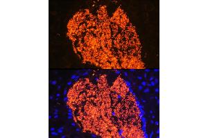 Immunofluorescence analysis of Mouse placenta using HB antibody (ABIN6129603, ABIN6141637, ABIN6141638 and ABIN6224486) at dilution of 1:100 (40x lens). (HBa2 anticorps  (AA 1-142))