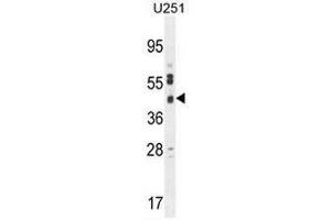 CB018 Antibody (C-term) western blot analysis in U251 cell line lysates (35µg/lane). (SLC35F6 anticorps  (C-Term))
