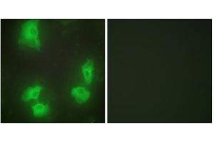 Immunofluorescence analysis of HeLa cells, using CDK5R1 antibody. (CDK5R1 anticorps  (N-Term))