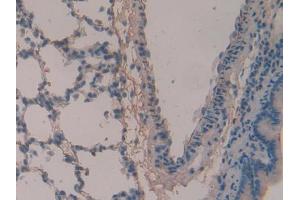 IHC-P analysis of Rat Lung Tissue, with DAB staining. (Periostin anticorps  (AA 659-810))