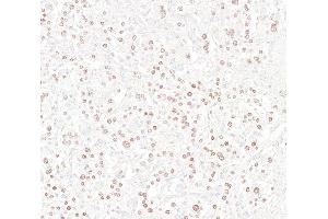 Immunohistochemistry (IHC) image for anti-Insulinoma-Associated 1 (INSM1) (AA 75-125) antibody (ABIN7795670) (Recombinant INSM1 anticorps  (AA 75-125))