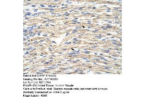Immunohistochemistry (IHC) image for anti-CDKN2A Interacting Protein (CDKN2AIP) (C-Term) antibody (ABIN2779115) (CDKN2AIP anticorps  (C-Term))