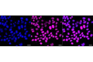 Immunocytochemical staining of HepG2 cells with Chromodomain helicase DNA binding protein 3 antibody (ABIN7798069), 1:1,000). (Recombinant CHD3 anticorps)