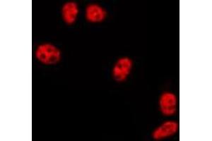 ABIN6275732 staining HepG2 by IF/ICC. (ZNF695 anticorps  (C-Term))