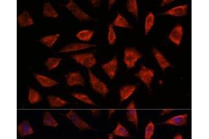 Immunofluorescence analysis of L929 cells using STAM2 Polyclonal Antibody at dilution of 1:100.