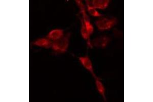 ABIN6275175 staining  HepG2 cells by IF/ICC. (GNAI3 anticorps  (N-Term))