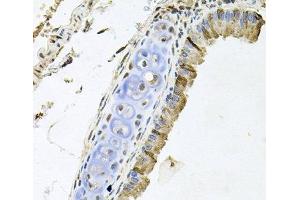 Immunohistochemistry of paraffin-embedded Mouse lung using ERBB4 Polyclonal Antibody at dilution of 1:100 (40x lens). (ERBB4 anticorps)