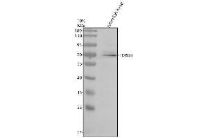 Western blot analysis of TDRD3 using anti-TDRD3 antibody (AZQ6NYG6).