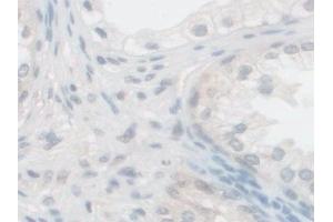 Detection of PCSK1 in Human Prostate Tissue using Polyclonal Antibody to Proprotein Convertase Subtilisin/Kexin Type 1 (PCSK1)