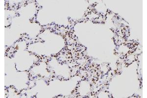 ABIN6276858 at 1/100 staining Rat lung tissue by IHC-P. (POLR2E anticorps  (Internal Region))