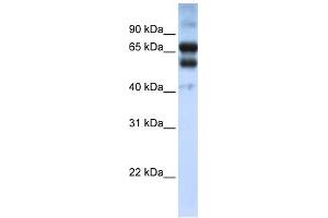 WB Suggested Anti-RARG Antibody Titration:  0. (Retinoic Acid Receptor gamma anticorps  (N-Term))